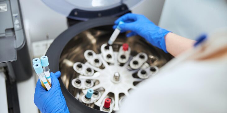 Ematologia e Coagulazione Ematologia e Coagulazione