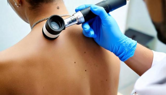 videodermatoscopia